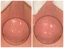 ビーフリー(Be free)/