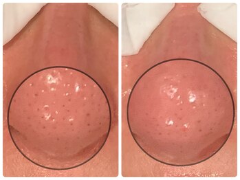 ビーフリー(Be free)/