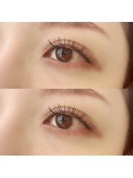 ヌナ(nuna)/マットフラットラッシュ140本