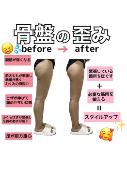 ステラ(stella)/歪みの原因となる筋肉ケア