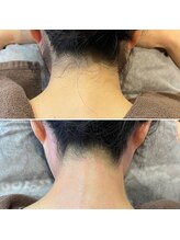 シャンティ(Shanti)/うなじ美人