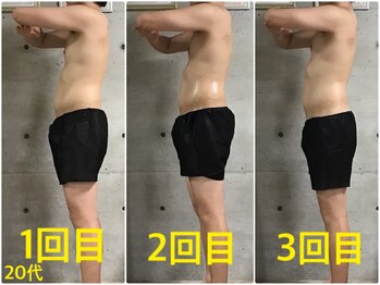 ペリー(PELLY)/男性20代 before after