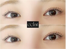 エクラ(eclat)/リフトカール