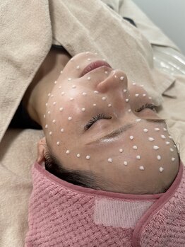 アネラ(ANERA)/毛穴に◎メソプロプラス