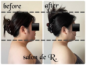 サロン ド アール(salon de R.)/【変わる骨美容・20代】