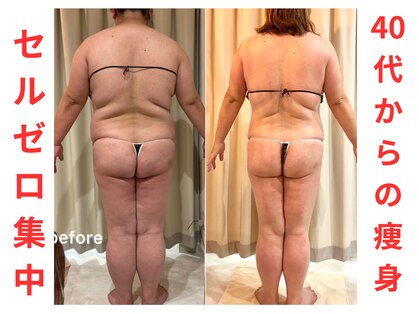 リノア(Lino'aka)の写真