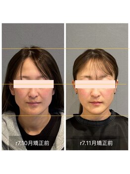 プライミー(PRIMY)/面長調節