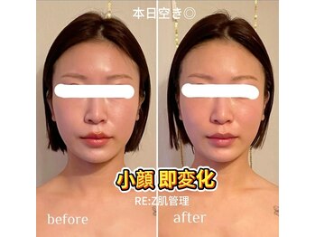 順蘭堂の写真/小顔×肌質改善｜毛穴・くすみ改善◎1回で変化実感