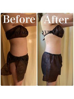 小顔屋ゆらやぎ/