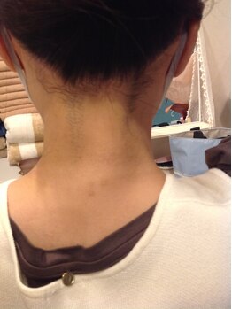 ミライズ(MIRAI'S)/成人式・前撮り前に→うなじ脱毛