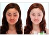 【最新美肌小顔セット誕生】速効性　小顔リフト＋幹細胞ハーブピーリング　