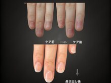 チャームドロップの雰囲気（深爪&噛み爪でお悩みの方、お任せ下さい！）