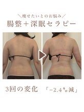 カラー(++ Color)/腸整＋深眠セラピー3回の変化