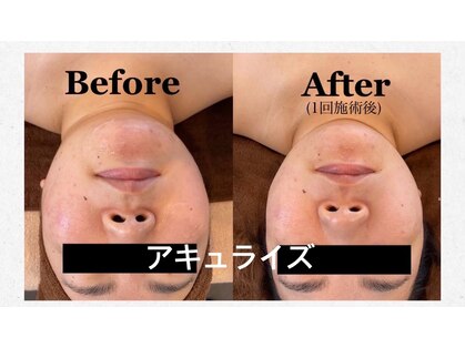 ベリンダ(BELINDA)の写真