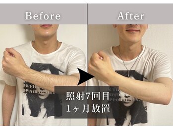 エルモリア(ELMOREA)/