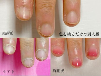 ウィッチ(witch)/乾燥がひどい方も施術後は綺麗に