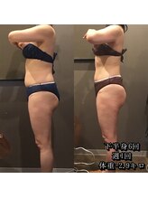 カルム エ コンポーゼ(Calme et Compose')/痩身セルゼロ／下半身6回