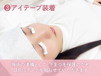リラ 大津京店(Lila)/3.アイテープ装着
