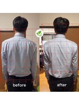 カイロプラクティック ネクサス/猫背と肩こり撃退☆