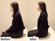 ソレア(Solea)/姿勢改善1回目 Before/After