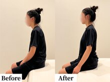 ソレア(Solea)/巻き肩改善1回目