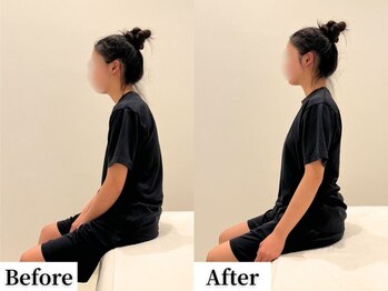 ソレア(Solea)/巻き肩改善1回目