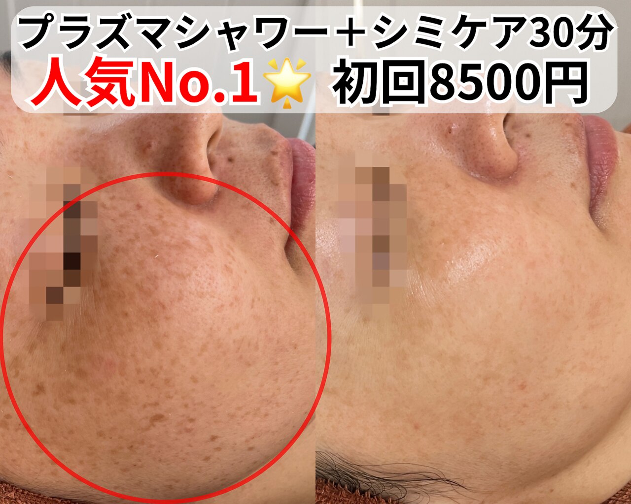 ベルファーム(Belle Femme)｜ホットペッパービューティー