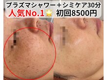 ベルファーム(Belle Femme)