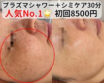 ベルファーム(Belle Femme)