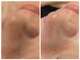 サロン ザ プマロ(SalonThePumalo)の写真/今日行けるサロン◎毛穴エクストラクションでつるん肌！短期集中コースでお肌の悩みを解消♪