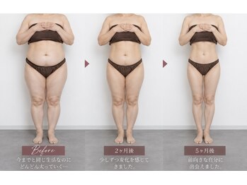 レン(ReN)の写真/「何も変えてないのに、1ヶ月で5kg増…」更年期・閉経期の止まらない体型変化、一人で悩まずReNへ
