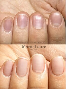 マリーロール 梅田店(Marie Laure)/自爪育成/深爪矯正/ネイルケア