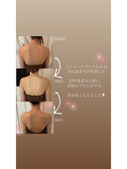 ルト(RUTO)/猫背改善で背面も別人！