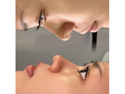 エムアンドエム(m&m)の写真