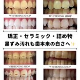 ホワイトニングショップ 小山店