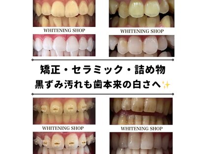 ホワイトニングショップ 小山店の写真