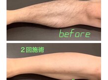 マゴイの雰囲気（Before→After）