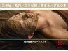 【人気NO1ニキビケア/毛穴】顔首ハーブピーリング＋肌別パック付17600→9900