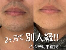 ダイヤ 名古屋中川区店(Daiya)の雰囲気（メンズ脱毛得意☆女性目線のアドバイスやご相談ご要望、大歓迎☆）