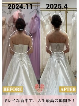 ヴィオーデ 錦糸町店/小顔、ブライダル、ウェディング