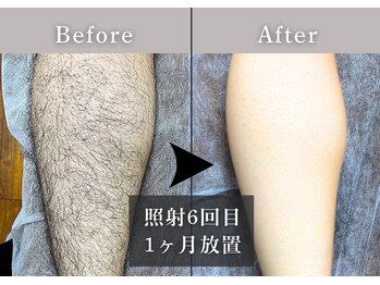 エルモリア(ELMOREA)/