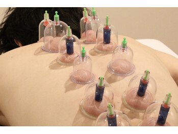 てらの鍼灸院 整体院/吸い玉