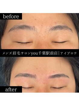 ユー 千葉駅前店(you)/ビフォ－アフター写真