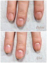 ソワン(soin)/Before→After