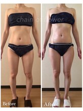 チェイン オブ フラワー(Chain Of Flower)/【脂肪ごっそり!】O脚改善し美脚