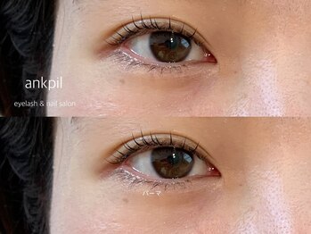 アノカプイル(ankpil)/