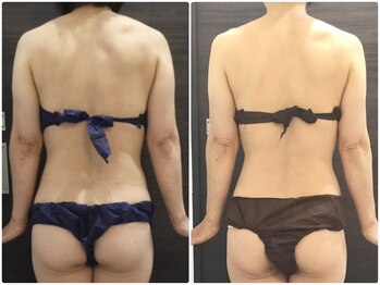 ウェリナ平和堂長久手院/小顔矯正/骨盤矯正/痩身/整体