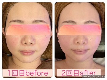 ベルフルールエム(Belle Fleur.M)/小顔はお任せください☆