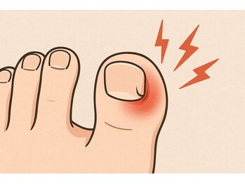 巻き爪じゅん 千葉駅前店/ &nbsp;巻き爪を放置すると重くなる