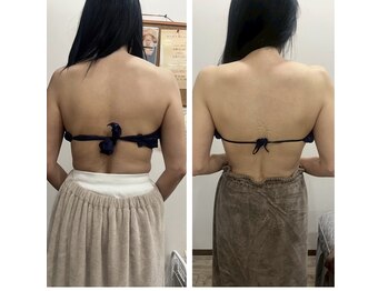 ココ平塚店(COCO)/背中やせもお任せ！！